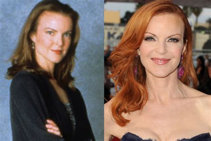 Marcia Cross Plastic Surgery Before and After